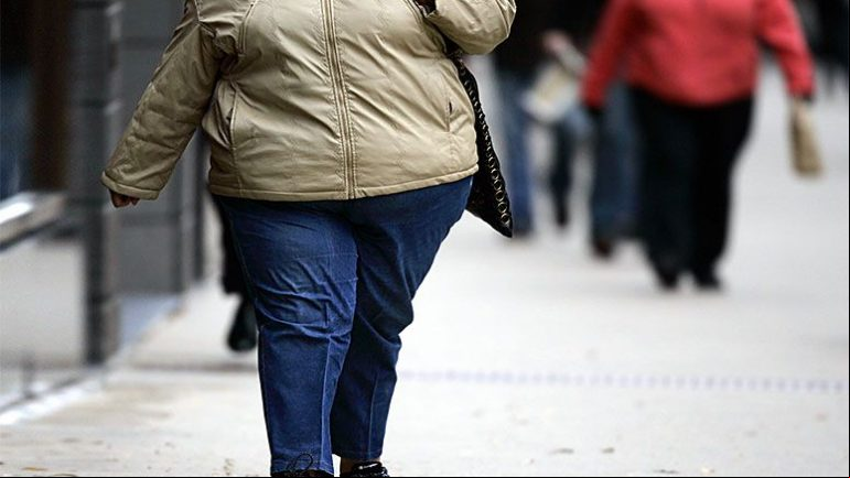 America’s Fattest City