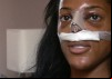 Bleach, Nip, Tuck: The White Beauty Myth