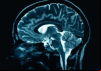 The Human Mind