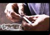 Krokodil: Russia’s Deadliest Drug