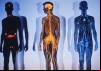 Paralyzed: Guillain-Barre Syndrome